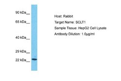 SCLT1 Rabbit anti-Human, Polyclonal, Novus Biologicals 0.1 mL | Buy Online | Novus Biologicals | Fisher Scientific